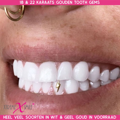 Gold Tooth Gem Lightning 22ct – Bold Dental Jewelry