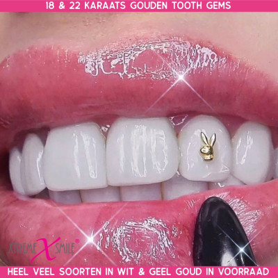Zahnschmuck Gold Playboy Bunny 18 kt – Tooth Gem