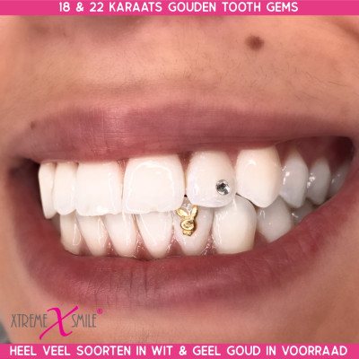 White Gold Tooth Gem Bunny Icon 18ct – Stylish Accent
