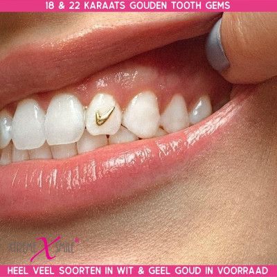 Zahnschmuck Gold Nike Zeichen 18 kt – Tooth Gem