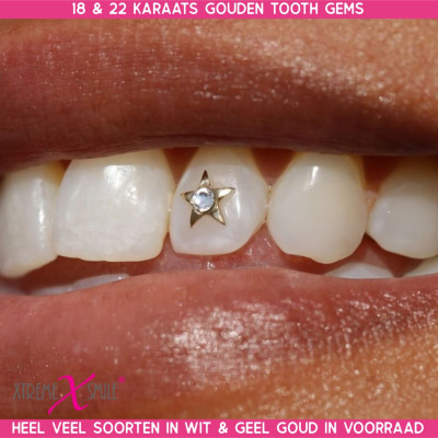 Gouden tooth gem ster met 0.01 kt diamant