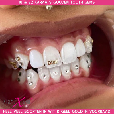 Gouden tooth gem Dior – 18 kt mode-accent