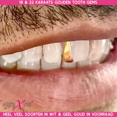 Witgouden tooth gem Slit 5.75 / 8 mm – slanke vorm