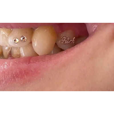 Tooth gem Bitch – bold goud/witgoud statement
