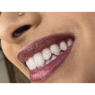 Toothgems Starter Kit - with mini course & videotraining. Dental jewelry starterkit.