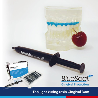 BlueSeal Gingival Barrier 2pcs for Gum Protection