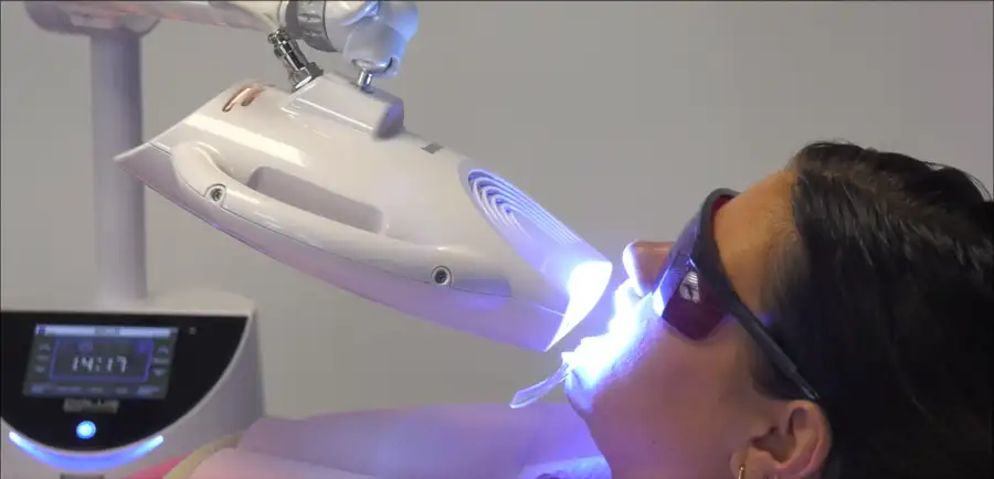 Professionele bleeklamp correct gepositioneerd tijdens een tandenbleekbehandeling