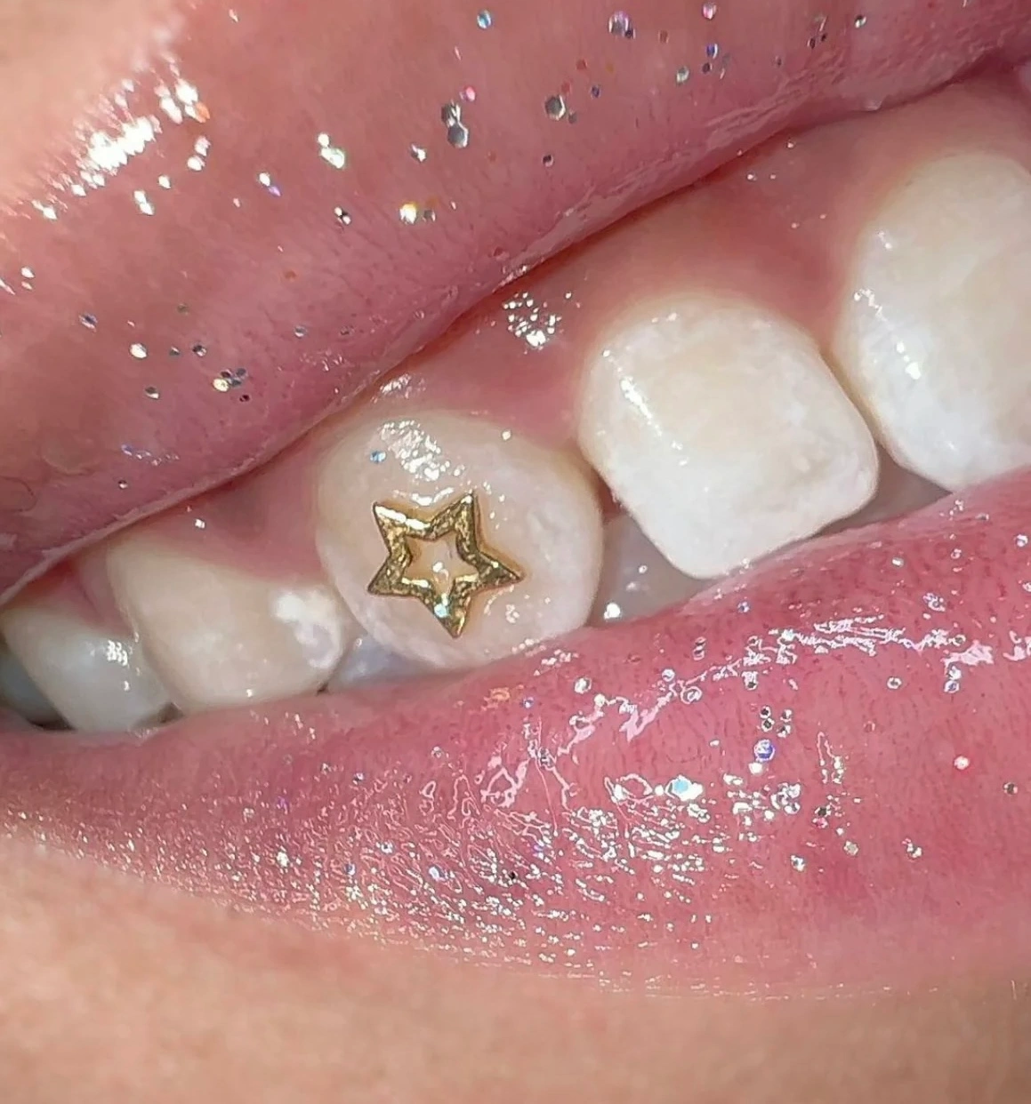 Gouden ster als tooth gem op een natuurlijke tand