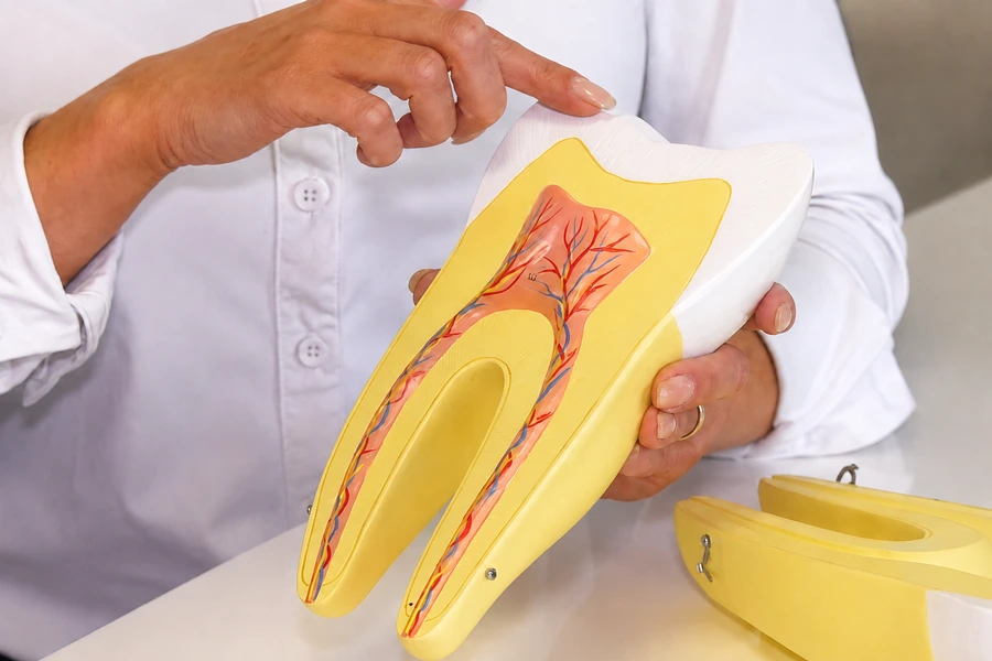 Tandheelkundig model gebruikt voor uitleg over tandoppervlak en tandanatomie tijdens de cursus Tooth Gems