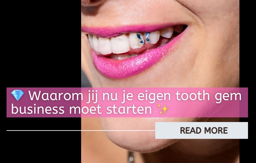 Waarom jij nu je eigen tooth gem business moet starten ✨